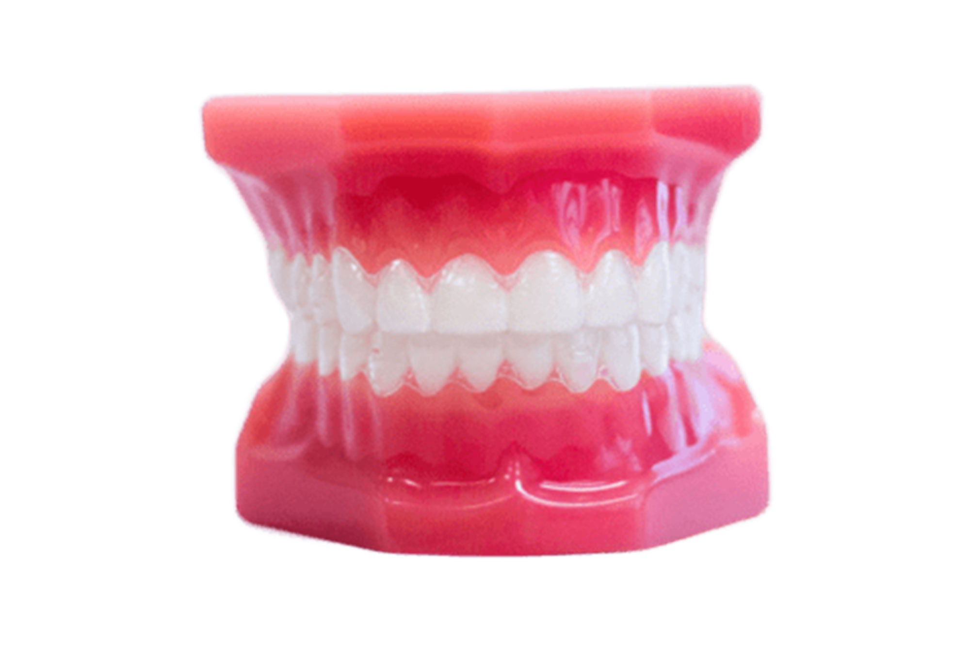 clear aligners image